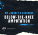 Below The Knee Amputation: My Story and First Steps To Recovery