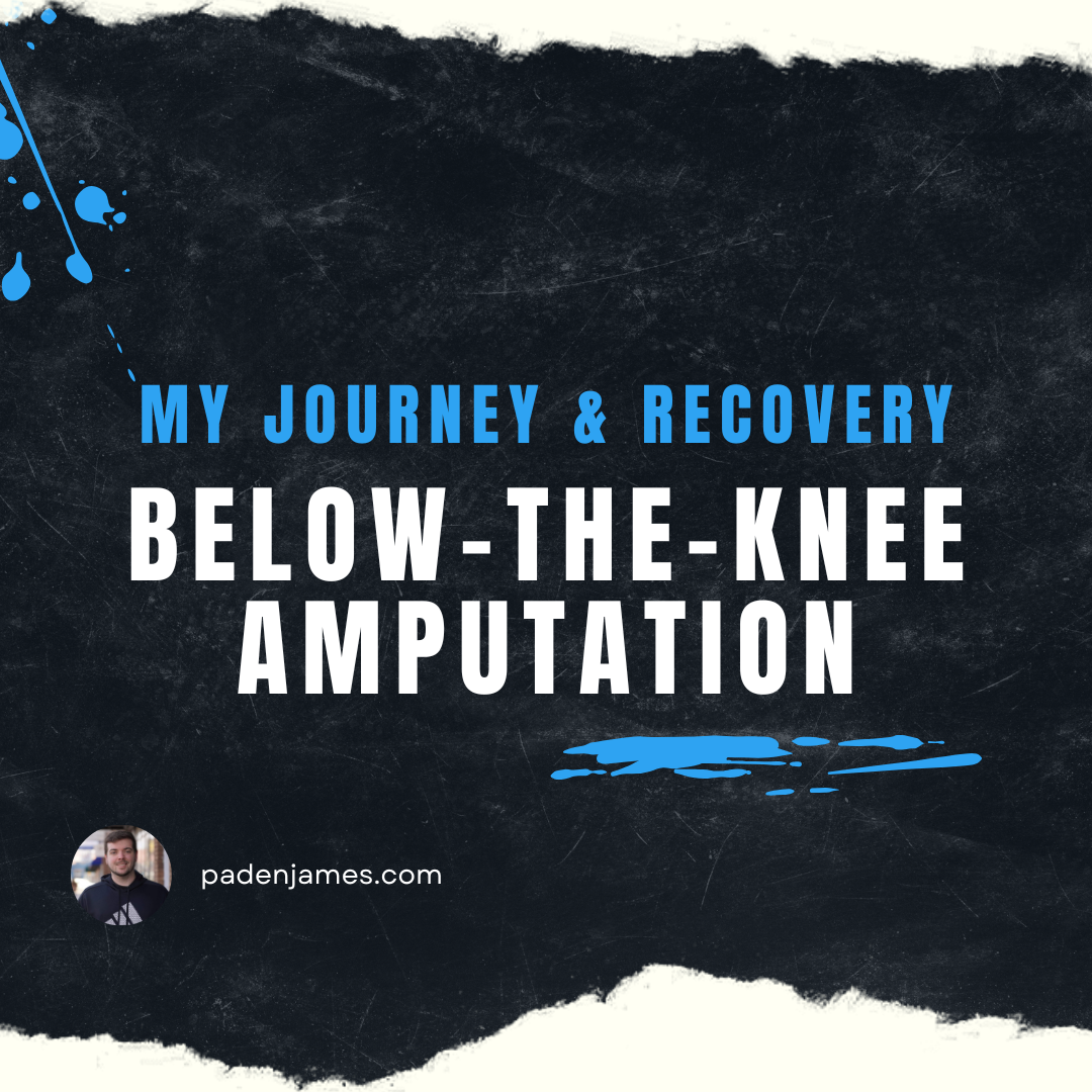 Below The Knee Amputation - My Story and First Steps of Recovery - PadenJames.com